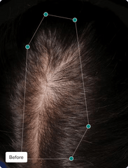 Hairbiotic MD Gut Microbiome Hair Growth By Nutrafol