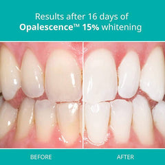 Opalescence at Home Teeth Whitening - Teeth Whitening Gel Syringes - 4 Pack of 15% Syringes - Mint